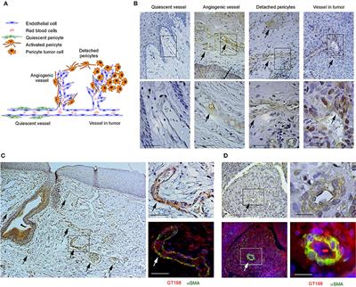 GT198 Is a Target of Oncology Drugs and Anticancer Herbs